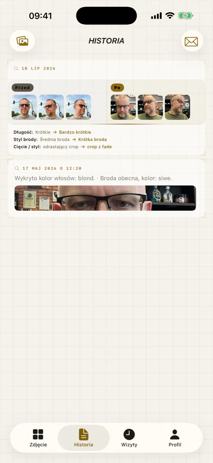 Lista historii z wizytą przed i po oraz starszą sesją.